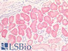 SLC2A2 / GLUT2 Antibody - Human Kidney: Formalin-Fixed, Paraffin-Embedded (FFPE)