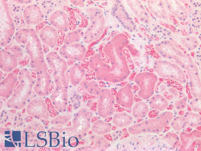 SLC2A2 / GLUT2 Antibody - Human Kidney: Formalin-Fixed, Paraffin-Embedded (FFPE)