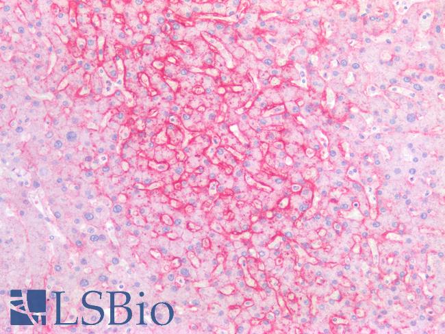 SLC2A2 / GLUT2 Antibody - Human Liver: Formalin-Fixed, Paraffin-Embedded (FFPE)