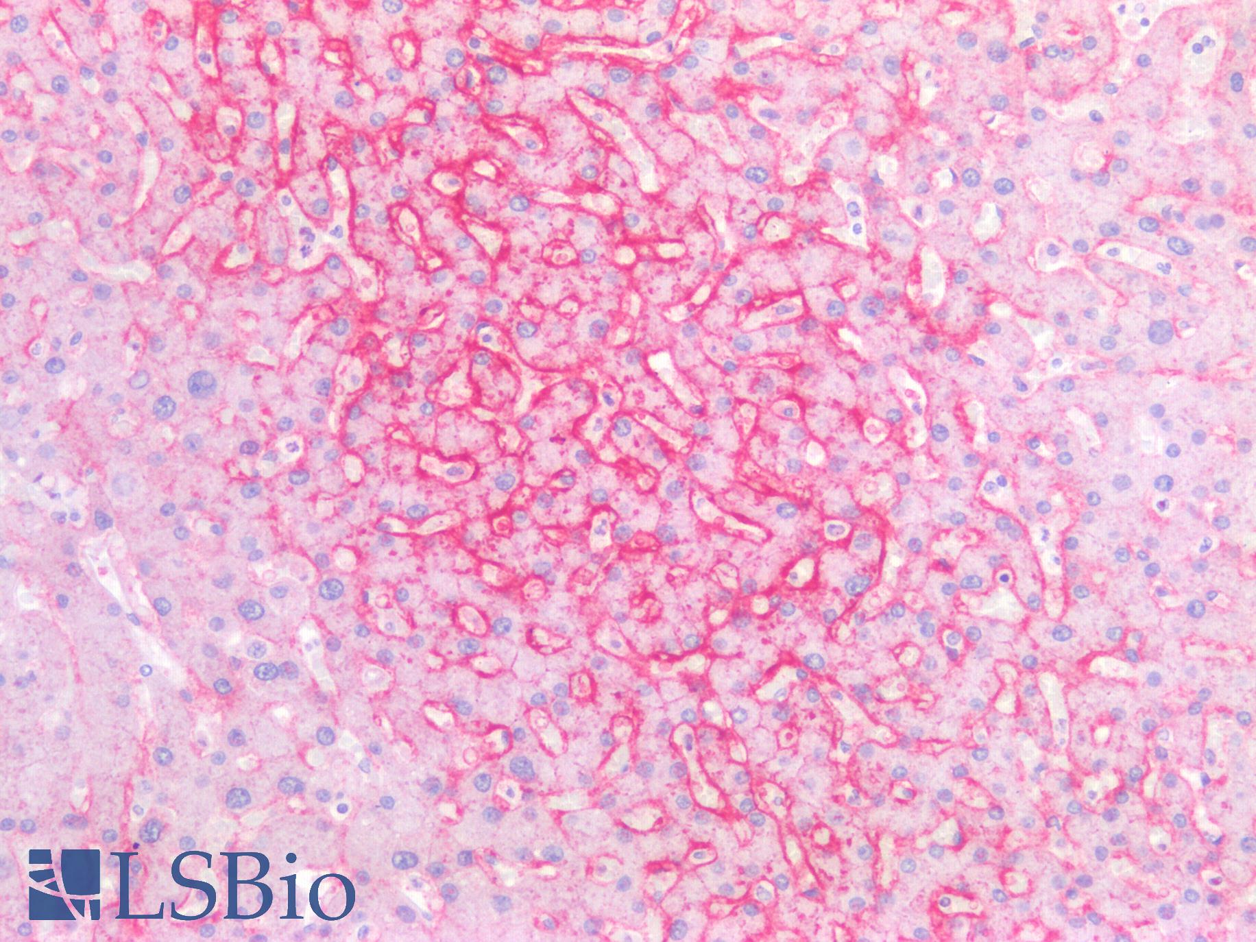 SLC2A2 / GLUT2 Antibody - Human Liver: Formalin-Fixed, Paraffin-Embedded (FFPE)