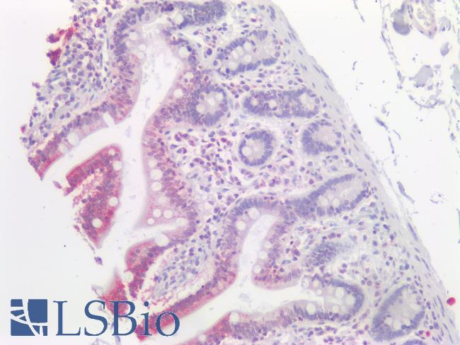 SLC2A2 / GLUT2 Antibody - Human Small Intestine: Formalin-Fixed, Paraffin-Embedded (FFPE)