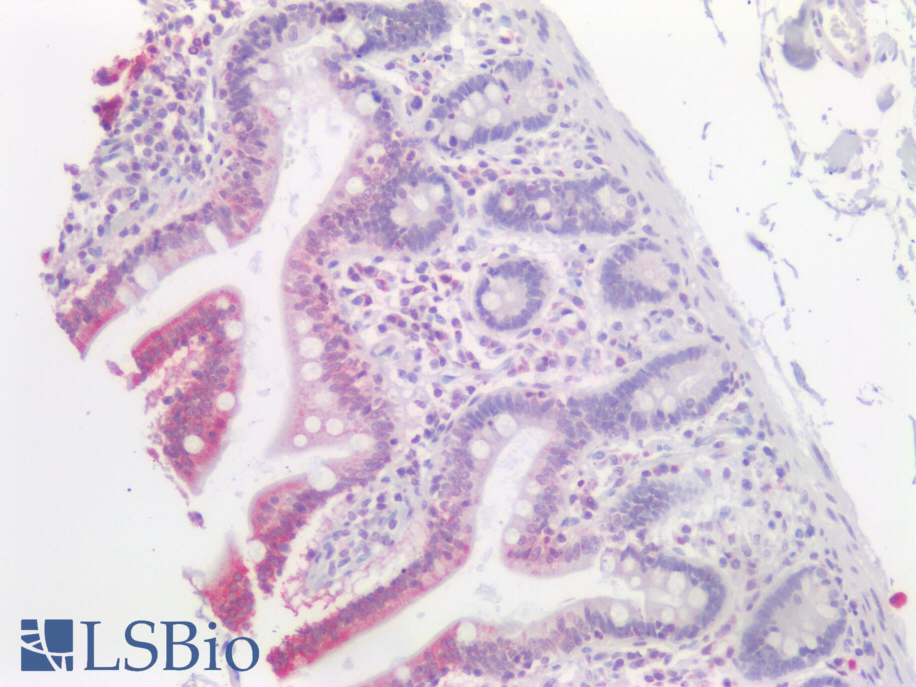 SLC2A2 / GLUT2 Antibody - Human Small Intestine: Formalin-Fixed, Paraffin-Embedded (FFPE)