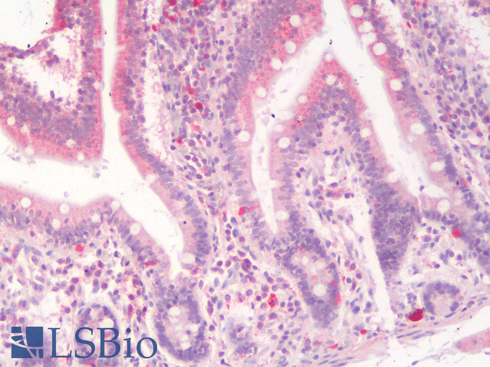 SLC40A1 / Ferroportin-1 Antibody - Human Small Intestine: Formalin-Fixed, Paraffin-Embedded (FFPE)
