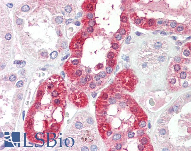 SLC6A8 Antibody - Anti-SLC6A8 antibody IHC staining of human kidney. Immunohistochemistry of formalin-fixed, paraffin-embedded tissue after heat-induced antigen retrieval. Antibody concentration 5 ug/ml.