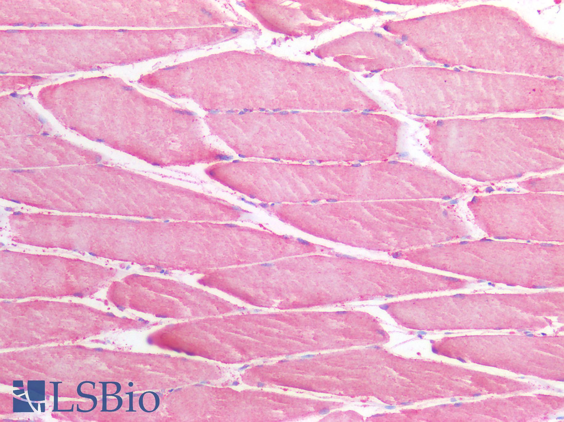 SLC6A8 Antibody - Human Skeletal Muscle: Formalin-Fixed, Paraffin-Embedded (FFPE)