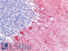 SLC6A8 Antibody - Human Brain, Cerebellum: Formalin-Fixed, Paraffin-Embedded (FFPE)