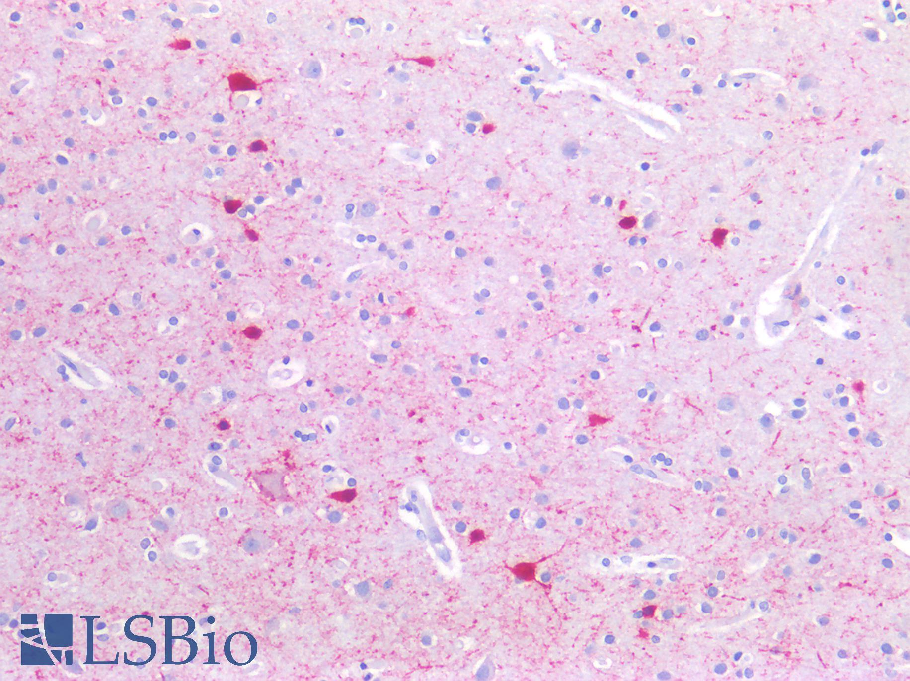 SLC6A8 Antibody - Human Brain, Cortex: Formalin-Fixed, Paraffin-Embedded (FFPE)