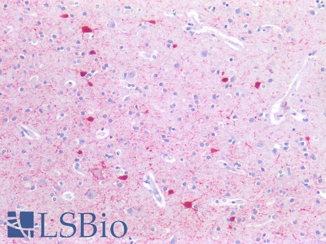 SLC6A8 Antibody - Human Brain, Cortex: Formalin-Fixed, Paraffin-Embedded (FFPE)