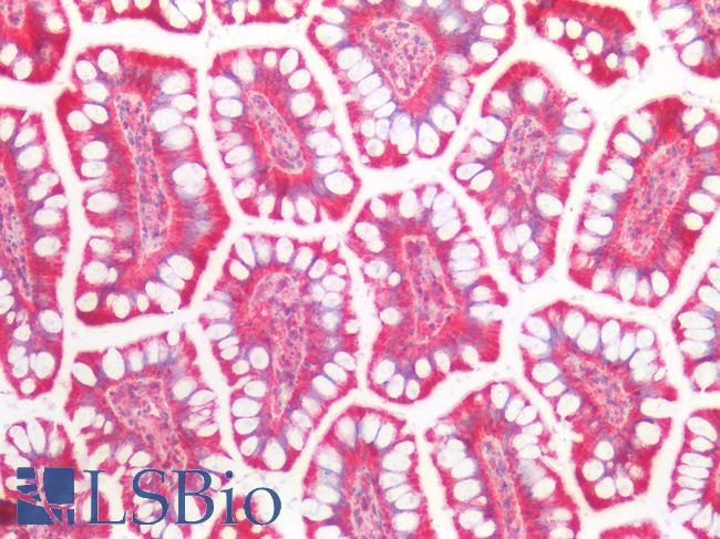 SLC9A3R1 / NHERF1 / EBP50 Antibody - Human Small Intestine: Formalin-Fixed, Paraffin-Embedded (FFPE)