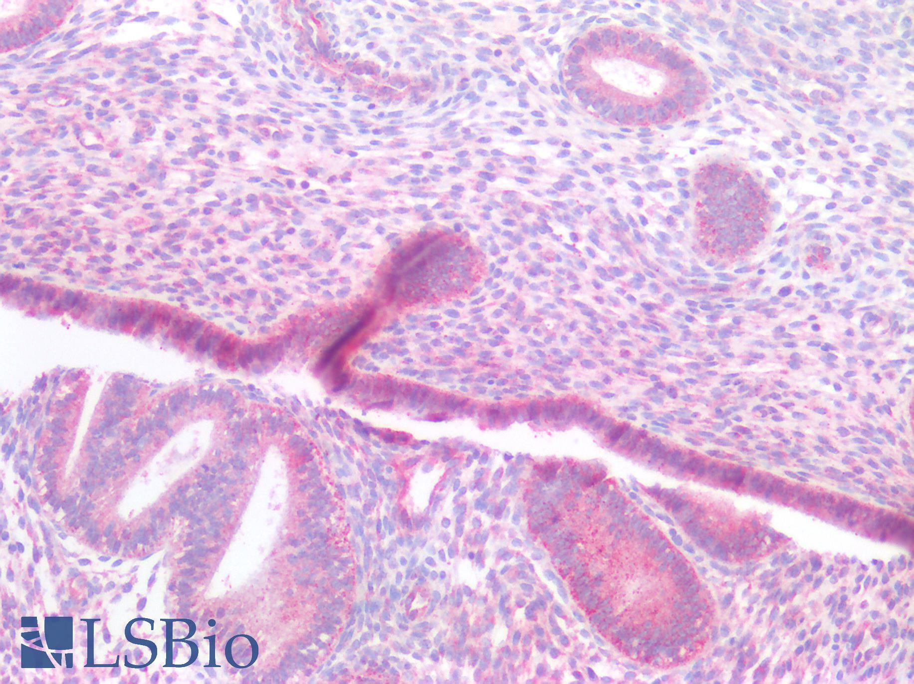 SLC9A3R1 / NHERF1 / EBP50 Antibody - Human Uterus: Formalin-Fixed, Paraffin-Embedded (FFPE)