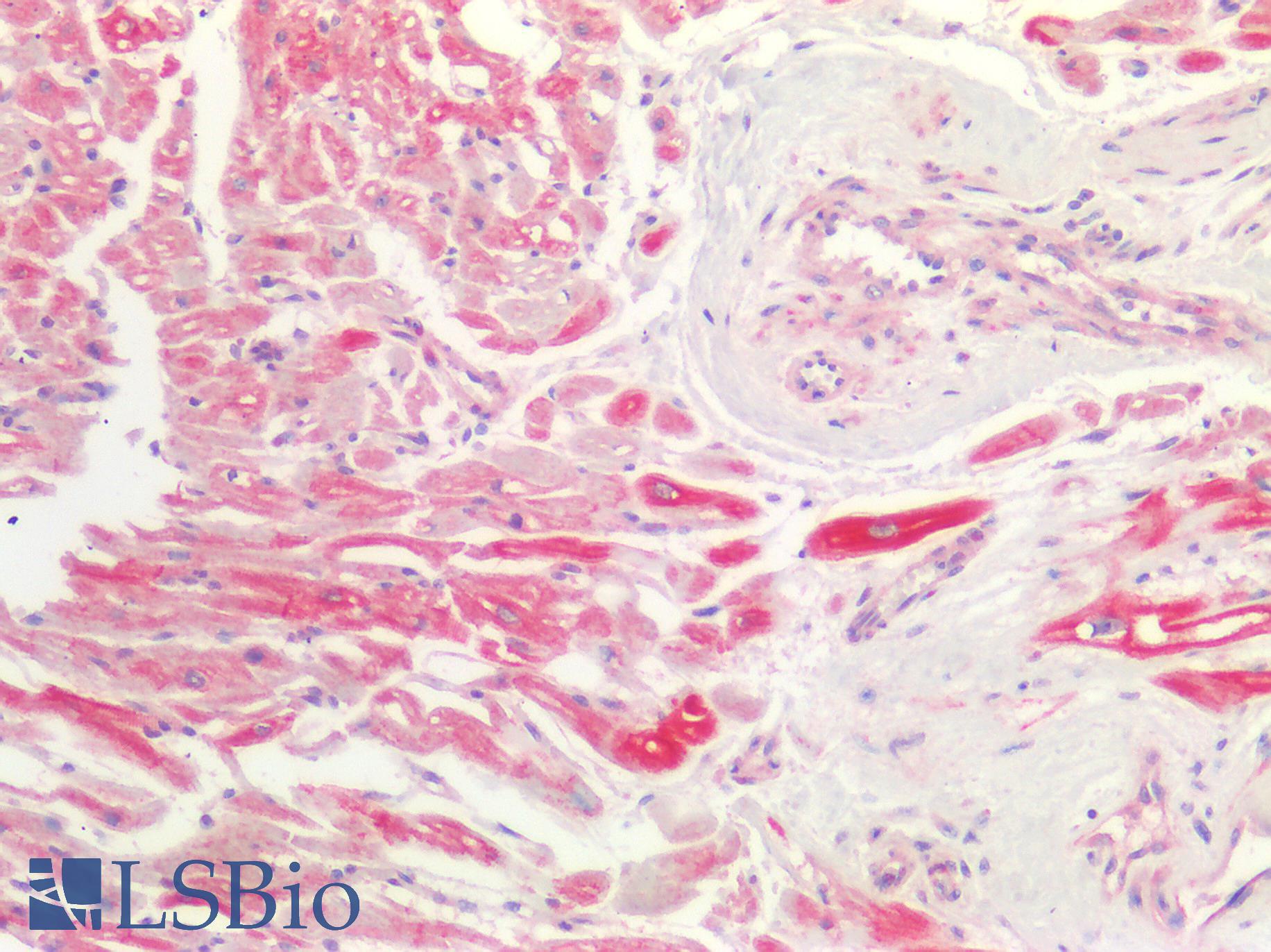 SMAD3 Antibody - Human Heart: Formalin-Fixed, Paraffin-Embedded (FFPE)