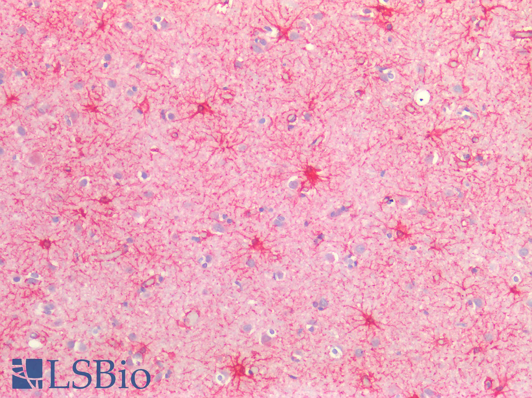 SMAD3 Antibody - Human Brain, Cortex: Formalin-Fixed, Paraffin-Embedded (FFPE)