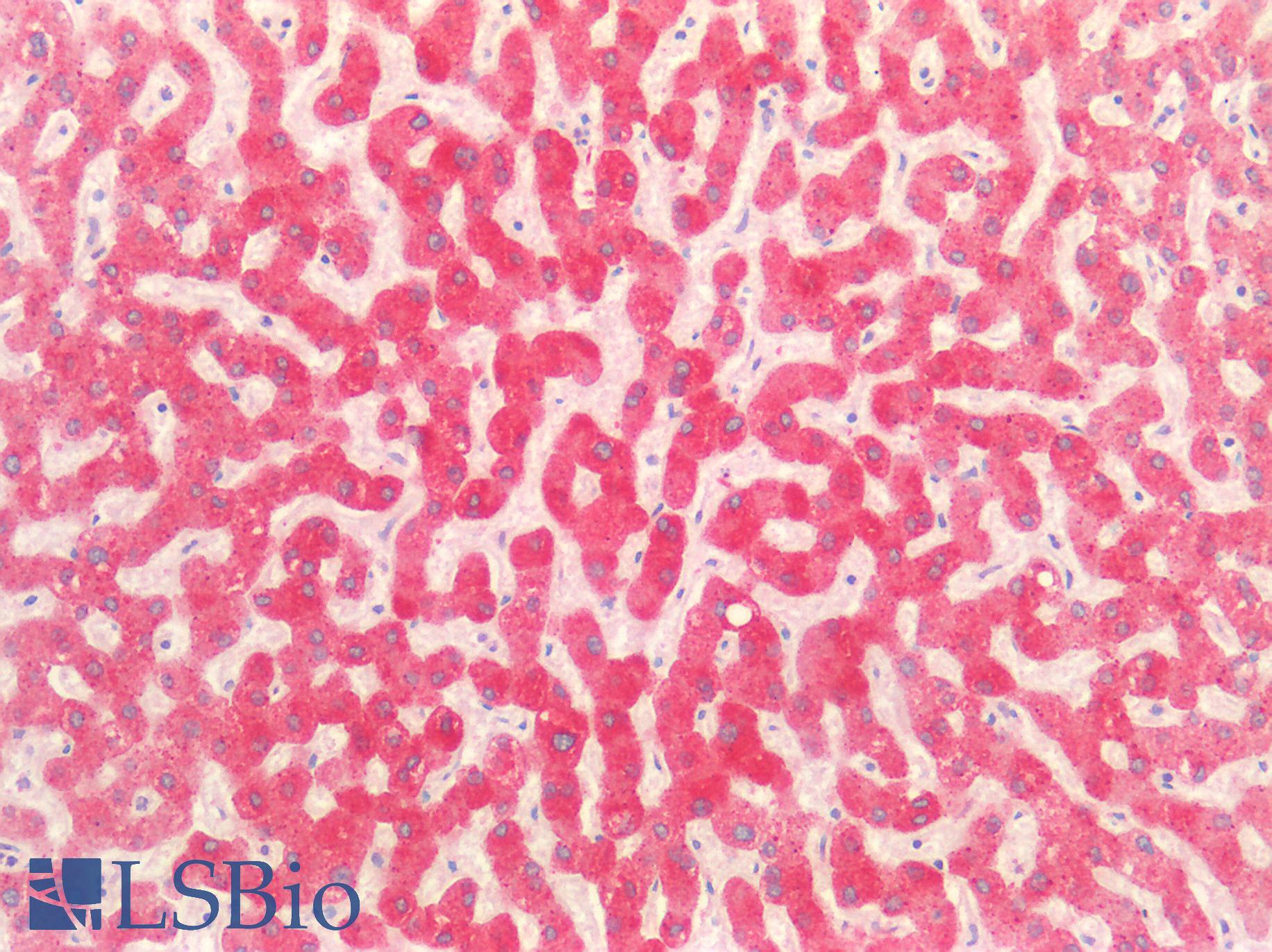 SMAD3 Antibody - Human Liver: Formalin-Fixed, Paraffin-Embedded (FFPE)