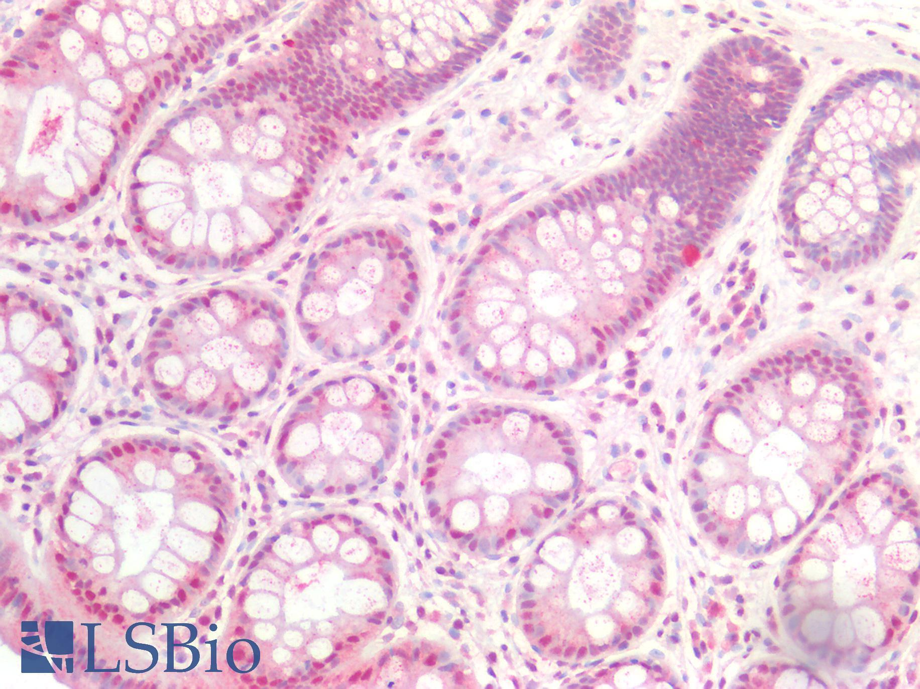 SMAD3 Antibody - Human Colon: Formalin-Fixed, Paraffin-Embedded (FFPE)