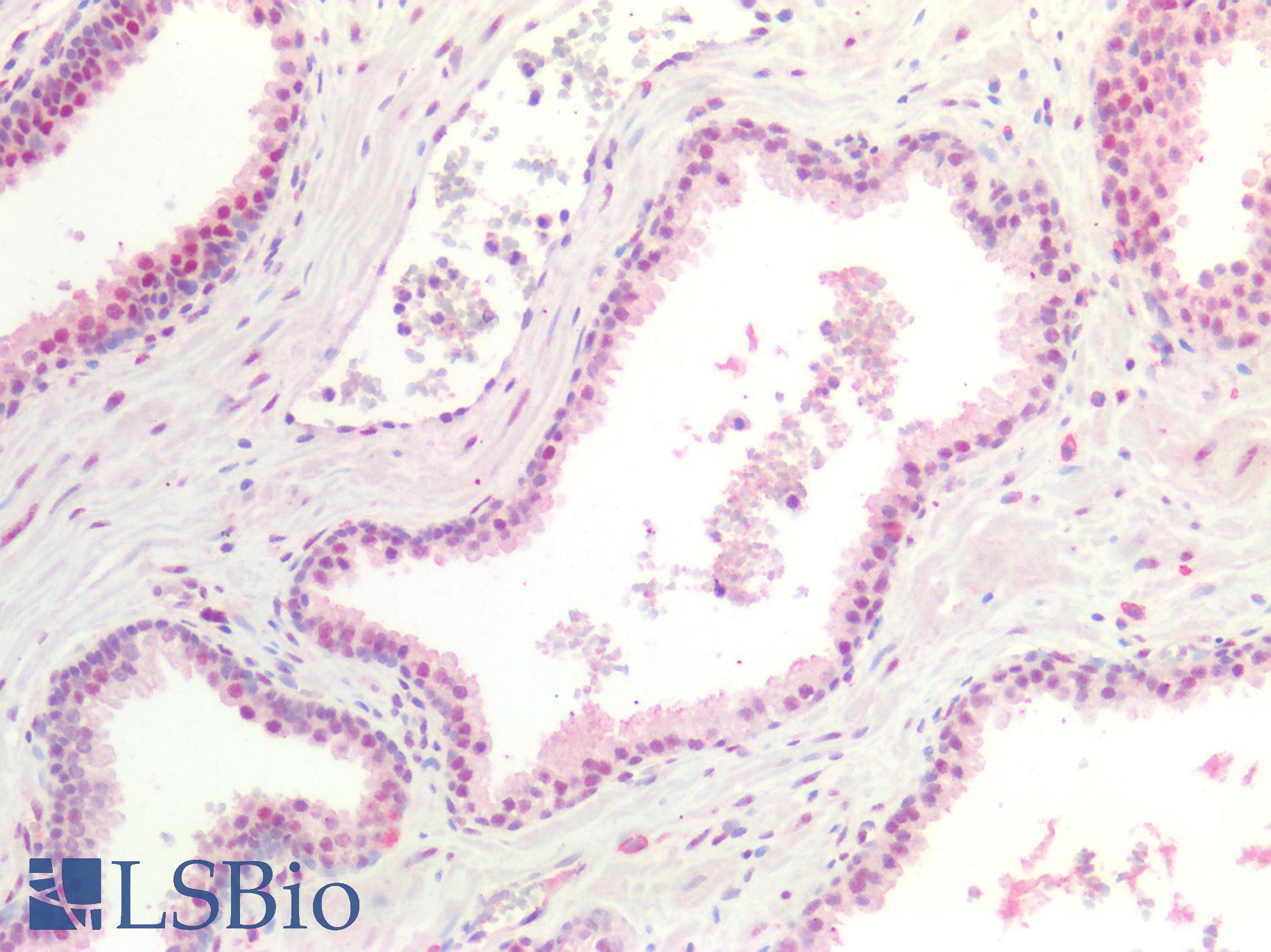 SMAD3 Antibody - Human Prostate: Formalin-Fixed, Paraffin-Embedded (FFPE)