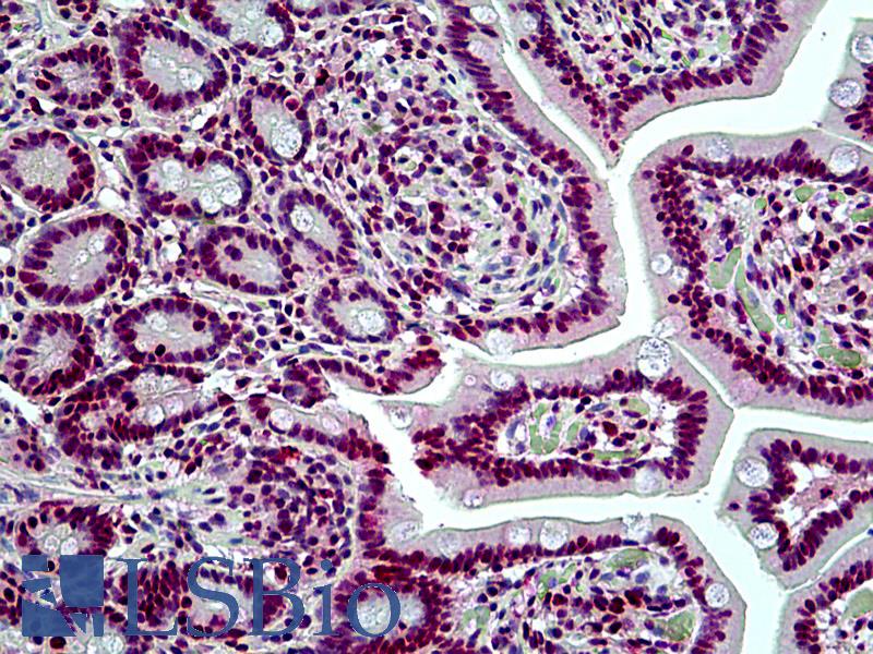 SMARCA4 / BRG1 Antibody - Anti-SMARCA4 / BRG1 antibody IHC of human small intestine. Immunohistochemistry of formalin-fixed, paraffin-embedded tissue after heat-induced antigen retrieval. Antibody concentration 3.75 ug/ml.