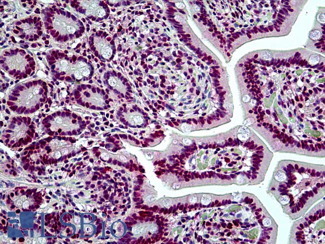 SMARCA4 / BRG1 Antibody - Anti-SMARCA4 / BRG1 antibody IHC of human small intestine. Immunohistochemistry of formalin-fixed, paraffin-embedded tissue after heat-induced antigen retrieval. Antibody concentration 3.75 ug/ml.