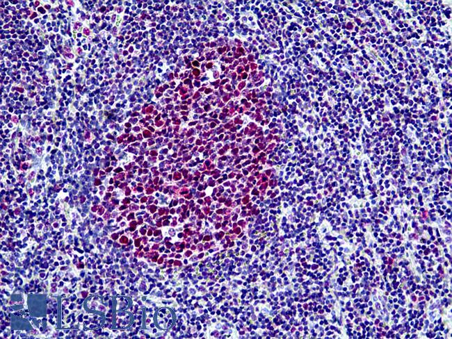 SMARCA4 / BRG1 Antibody - Anti-SMARCA4 / BRG1 antibody IHC of human tonsil. Immunohistochemistry of formalin-fixed, paraffin-embedded tissue after heat-induced antigen retrieval. Antibody concentration 3.75 ug/ml.