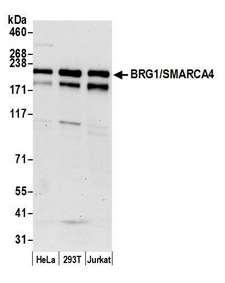 SMARCA4 / BRG1 Antibody - Detection of human BRG1/SMARCA4 by western blot. Samples: Whole cell lysate (15 µg) from HeLa, HEK293T, and Jurkat cells prepared using NETN lysis buffer. Antibody: Affinity purified rabbit anti-BRG1/SMARCA4 antibody used for WB at 0.1 µg/ml. Detection: Chemiluminescence with an exposure time of 30 seconds.