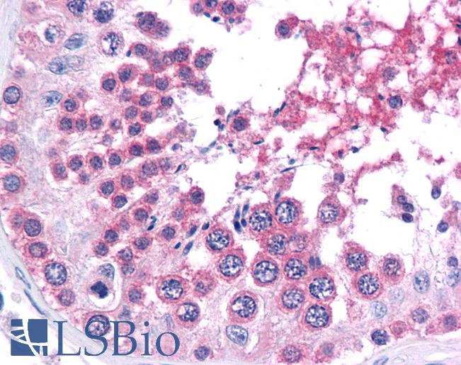 SMARCA4 / BRG1 Antibody - Anti-SMARCA4 / BRG1 antibody IHC of human testis. Immunohistochemistry of formalin-fixed, paraffin-embedded tissue after heat-induced antigen retrieval. Antibody concentration 10 ug/ml.