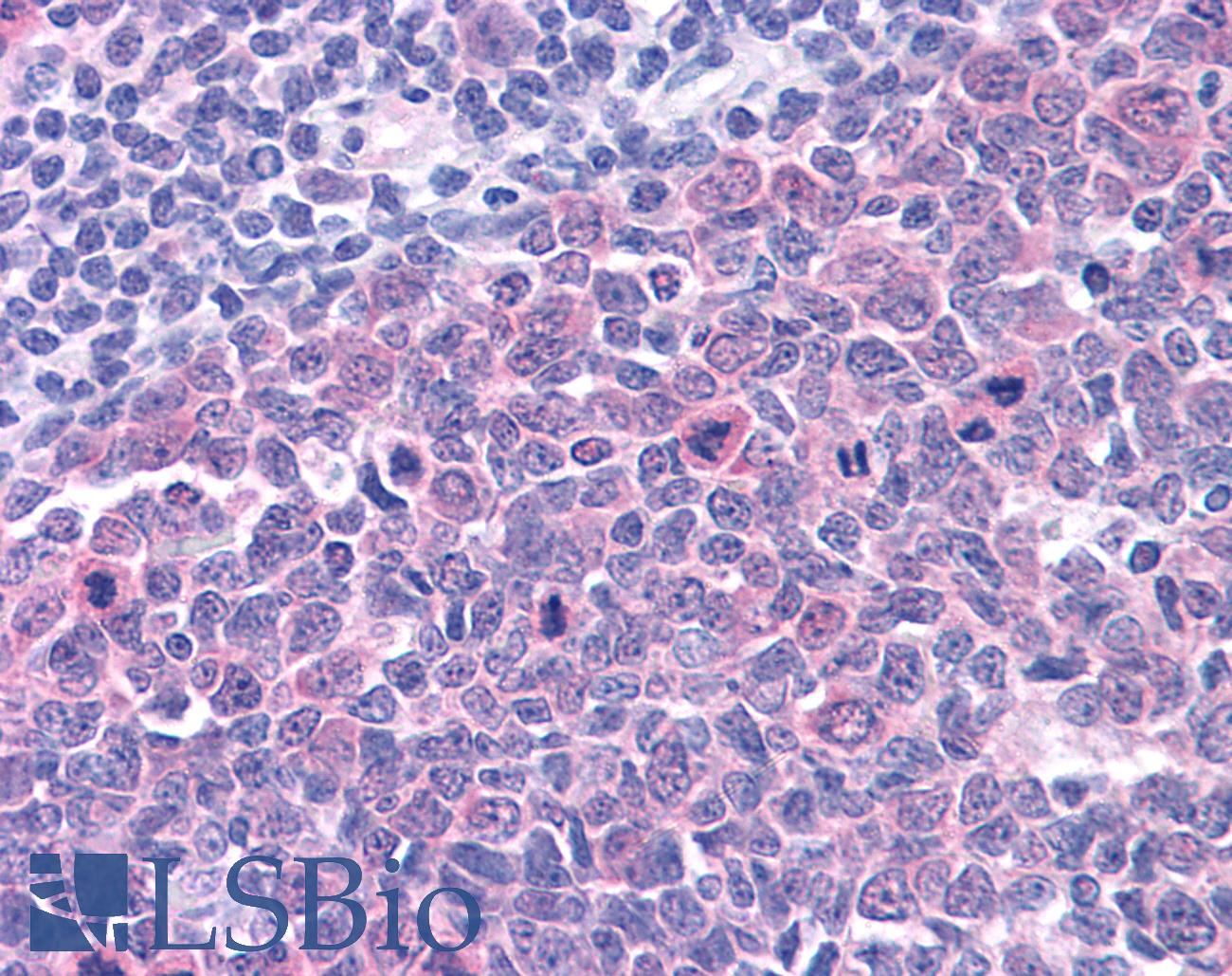SMARCA4 / BRG1 Antibody - Anti-SMARCA4 / BRG1 antibody IHC of human tonsil. Immunohistochemistry of formalin-fixed, paraffin-embedded tissue after heat-induced antigen retrieval. Antibody concentration 10 ug/ml.