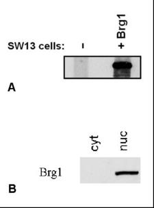 SMARCA4 / BRG1 Antibody - Immunostaining of Brg1 by BRG-01 antibody.    A - Brg1-negative SW13 cells were transfected with Brg1-expression plasmid and analysed by Western blotting for Brg1 expression.    B - HEK293 cytoplasmic (cyt) and nuclear (nuc) lysates were analysed by Western blotting for Brg1 presence.