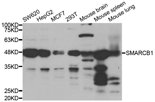 SMARCB1 / INI1 Antibody - Western blot analysis of extracts of various cell lines, using SMARCB1 antibody.