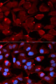 SMARCB1 / INI1 Antibody - Immunofluorescence analysis of U20S cell using SMARCB1 antibody. Blue: DAPI for nuclear staining.