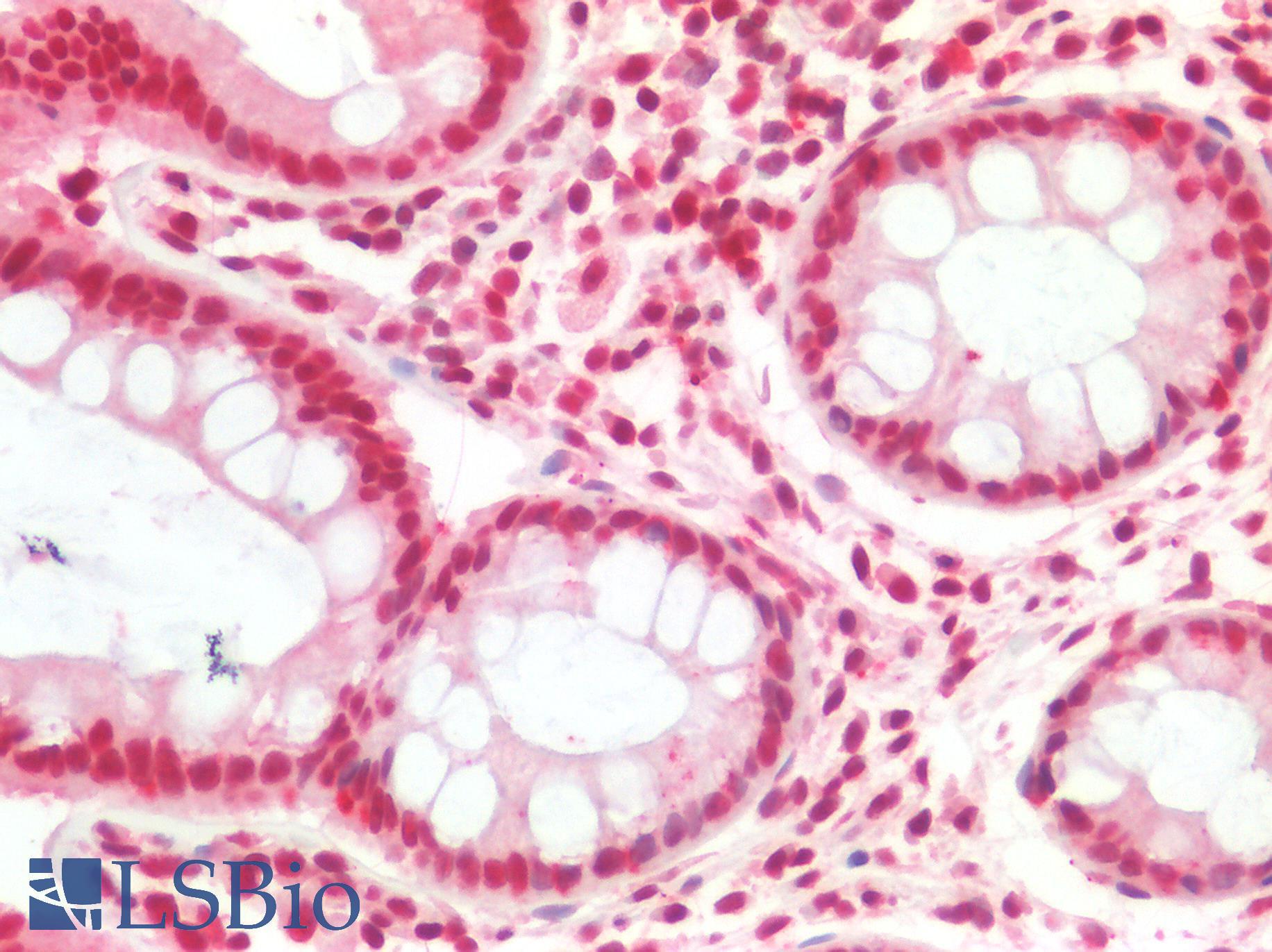 SMARCB1 / INI1 Antibody - Human Colon: Formalin-Fixed, Paraffin-Embedded (FFPE)