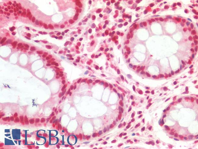 SMARCB1 / INI1 Antibody - Human Colon: Formalin-Fixed, Paraffin-Embedded (FFPE)