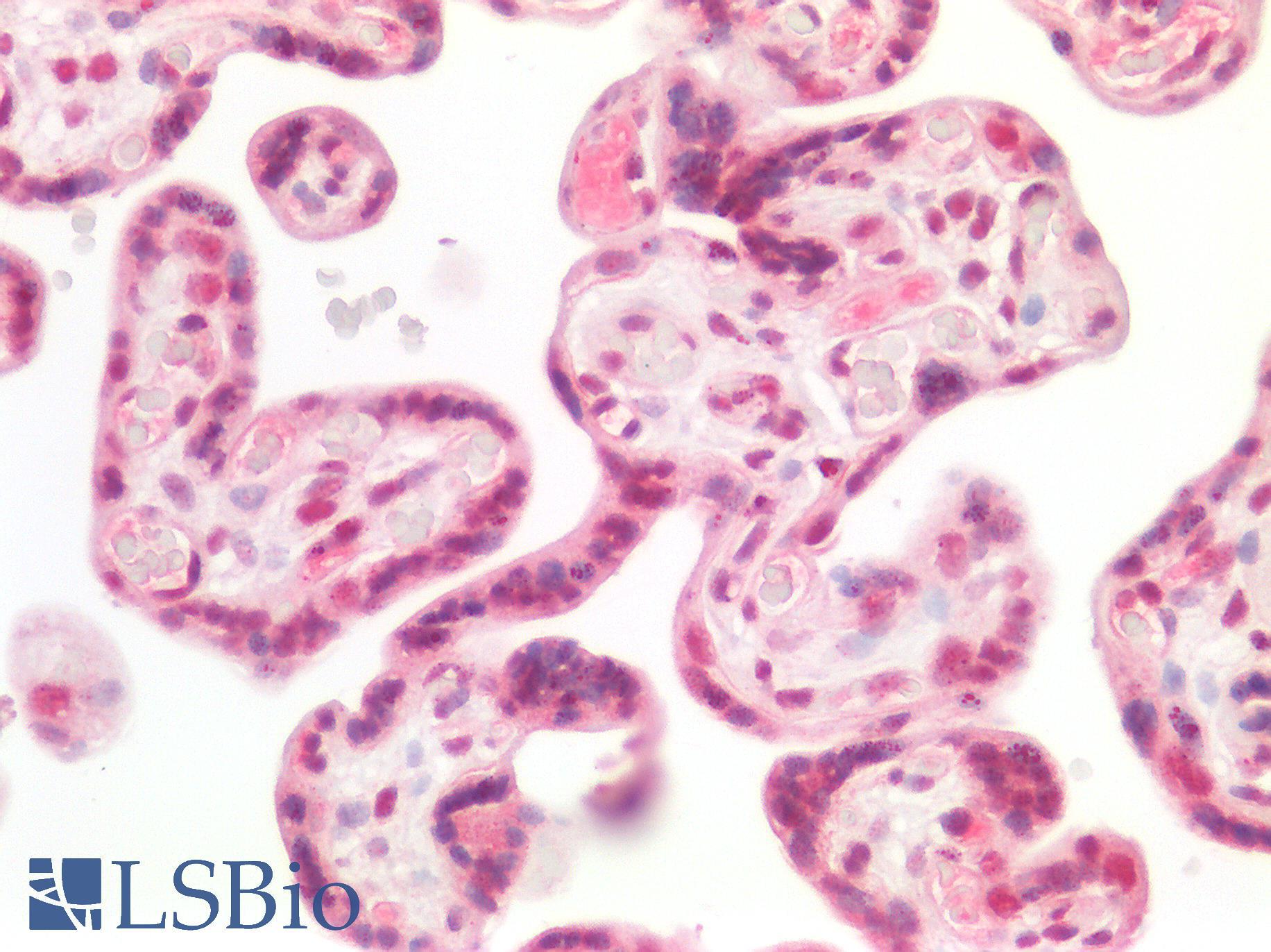 SMARCB1 / INI1 Antibody - Human Placenta: Formalin-Fixed, Paraffin-Embedded (FFPE)