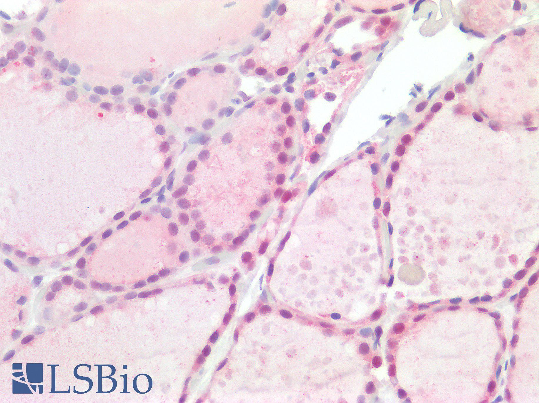 SMARCB1 / INI1 Antibody - Human Thyroid: Formalin-Fixed, Paraffin-Embedded (FFPE)