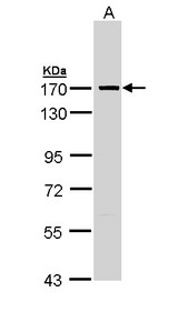 SMC1A / SMC1 Antibody - Sample (30 ug of whole cell lysate). A: Molt-4 . 7.5% SDS PAGE. SMC1A / SMC1 antibody diluted at 1:5000