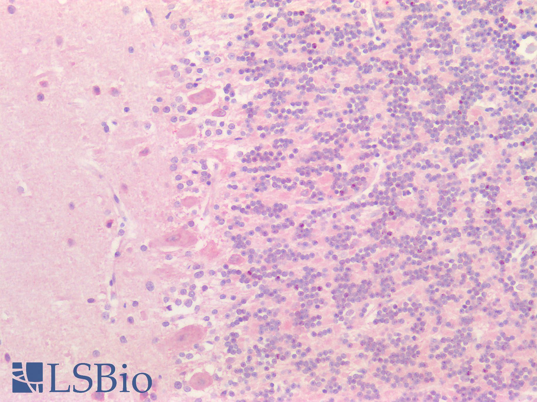 SMC1A / SMC1 Antibody - Human Brain, Cerebellum: Formalin-Fixed, Paraffin-Embedded (FFPE)