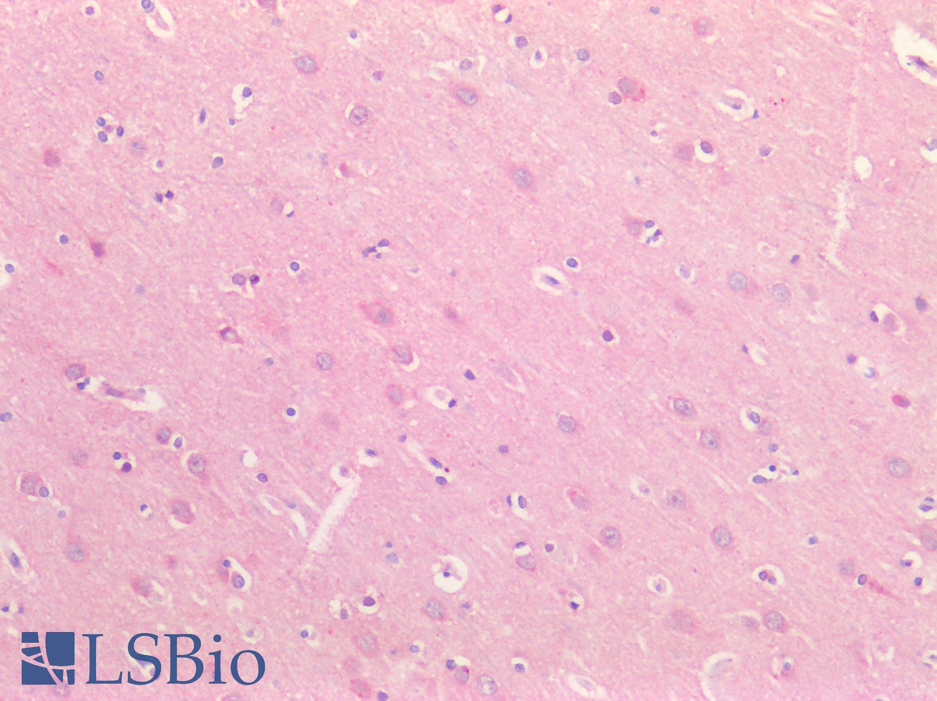 SMC1A / SMC1 Antibody - Human Brain, Cortex: Formalin-Fixed, Paraffin-Embedded (FFPE)