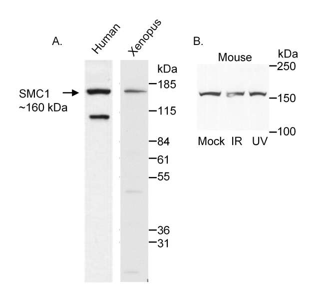 SMC1A / SMC1 Antibody - Detection of Human, Mouse and Xenopus SMC1 by Western Blot. Samples: A. Nuclear extracts from HeLa cells (50 ug) and Xenopus oocytes (100 ug). B. Whole cell lysate (100 ug) from MEF cells. Antibody: Affinity purified rabbit anti-SMC1 used at 1 ug/ml (A. Human), 2 ug/ml (A. Xenopus) or 0.5 ug/ml (B. Mouse). Detection: Chemiluminescence.