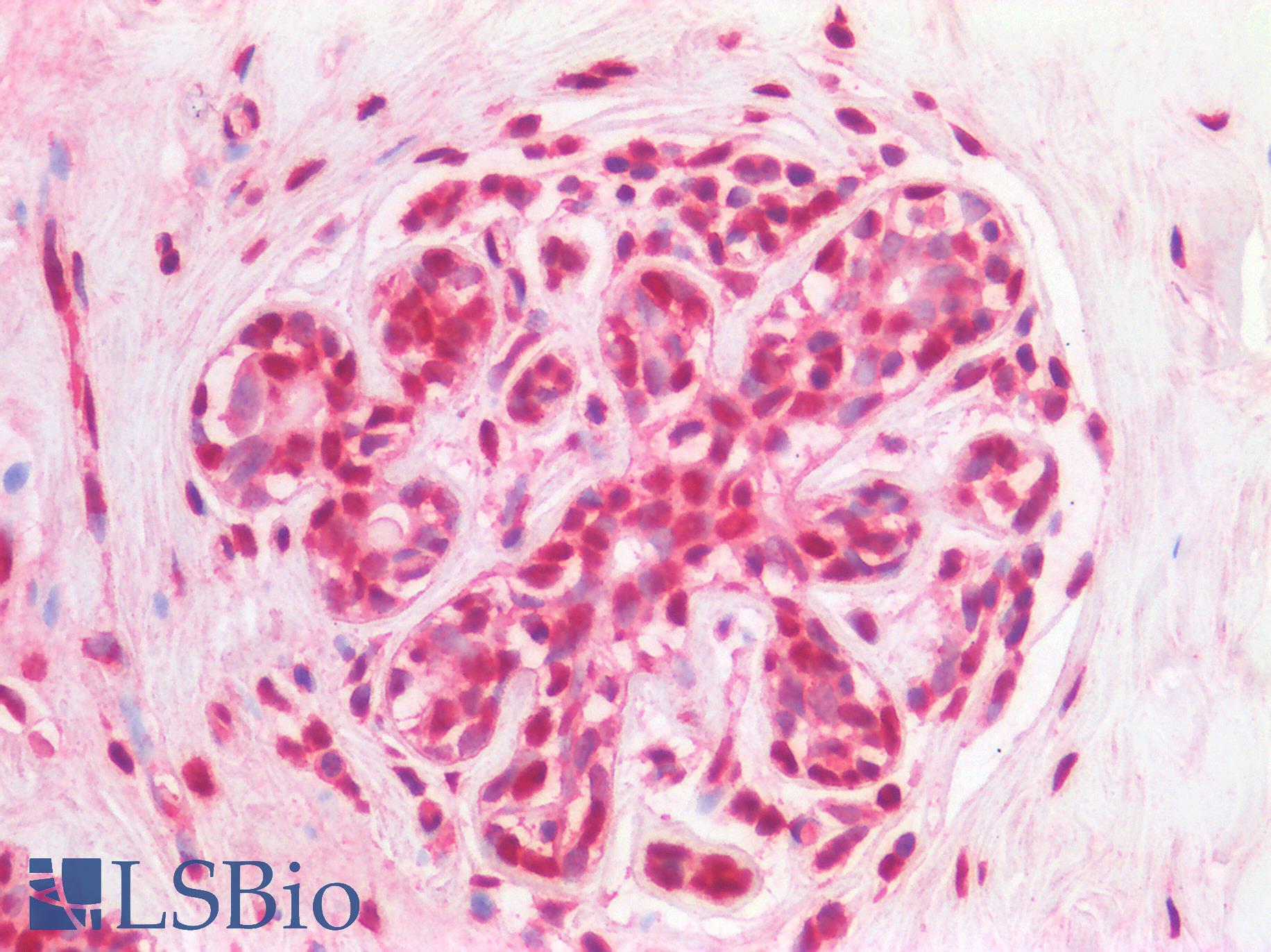 SMC1A / SMC1 Antibody - Human Breast: Formalin-Fixed, Paraffin-Embedded (FFPE)