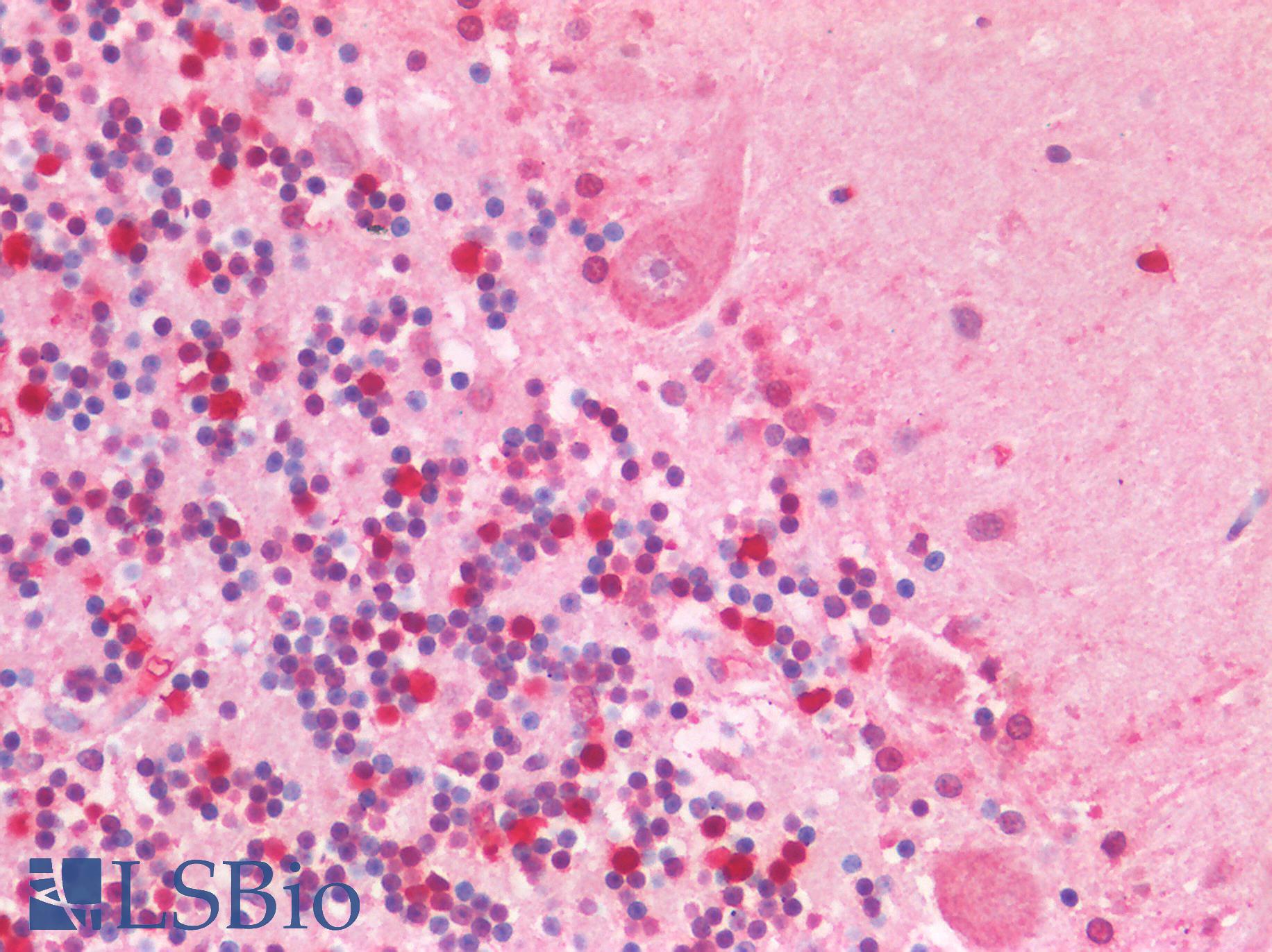 SMC1A / SMC1 Antibody - Human Cerebellum: Formalin-Fixed, Paraffin-Embedded (FFPE)