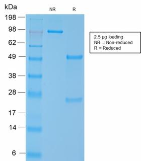SMMHC / MYH11 Antibody - SDS-PAGE Analysis Purified SM-MHC Recombinant Rabbit Monoclonal Antibody (MYH11/2303R). Confirmation of Purity and Integrity of the Antibody.
