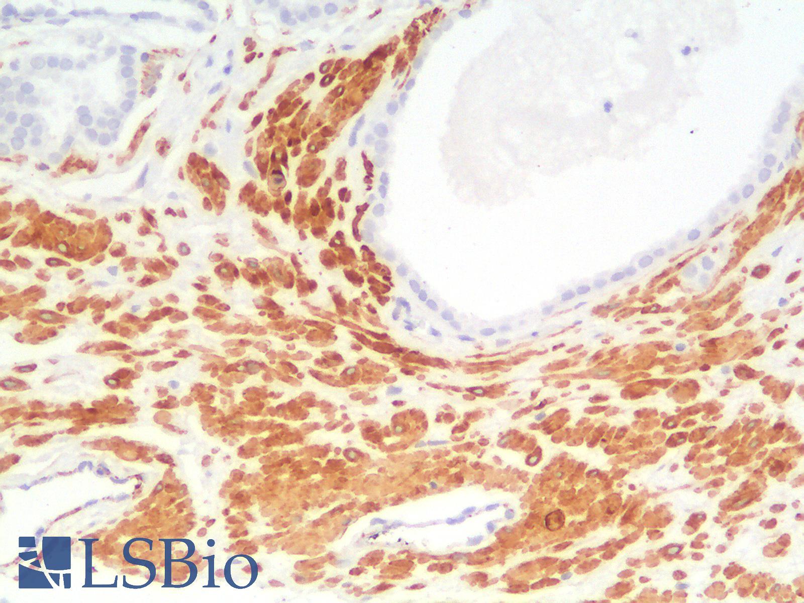 SMMHC / MYH11 Antibody - Human Prostate: Formalin-Fixed, Paraffin-Embedded (FFPE)