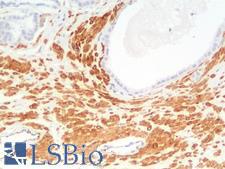 SMMHC / MYH11 Antibody - Human Prostate: Formalin-Fixed, Paraffin-Embedded (FFPE)