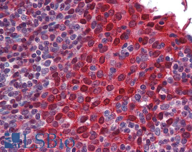 SMN1 Antibody - Anti-SMN1 antibody IHC of human tonsil. Immunohistochemistry of formalin-fixed, paraffin-embedded tissue after heat-induced antigen retrieval. Antibody concentration 5 ug/ml.  This image was taken for the unconjugated form of this product. Other forms have not been tested.