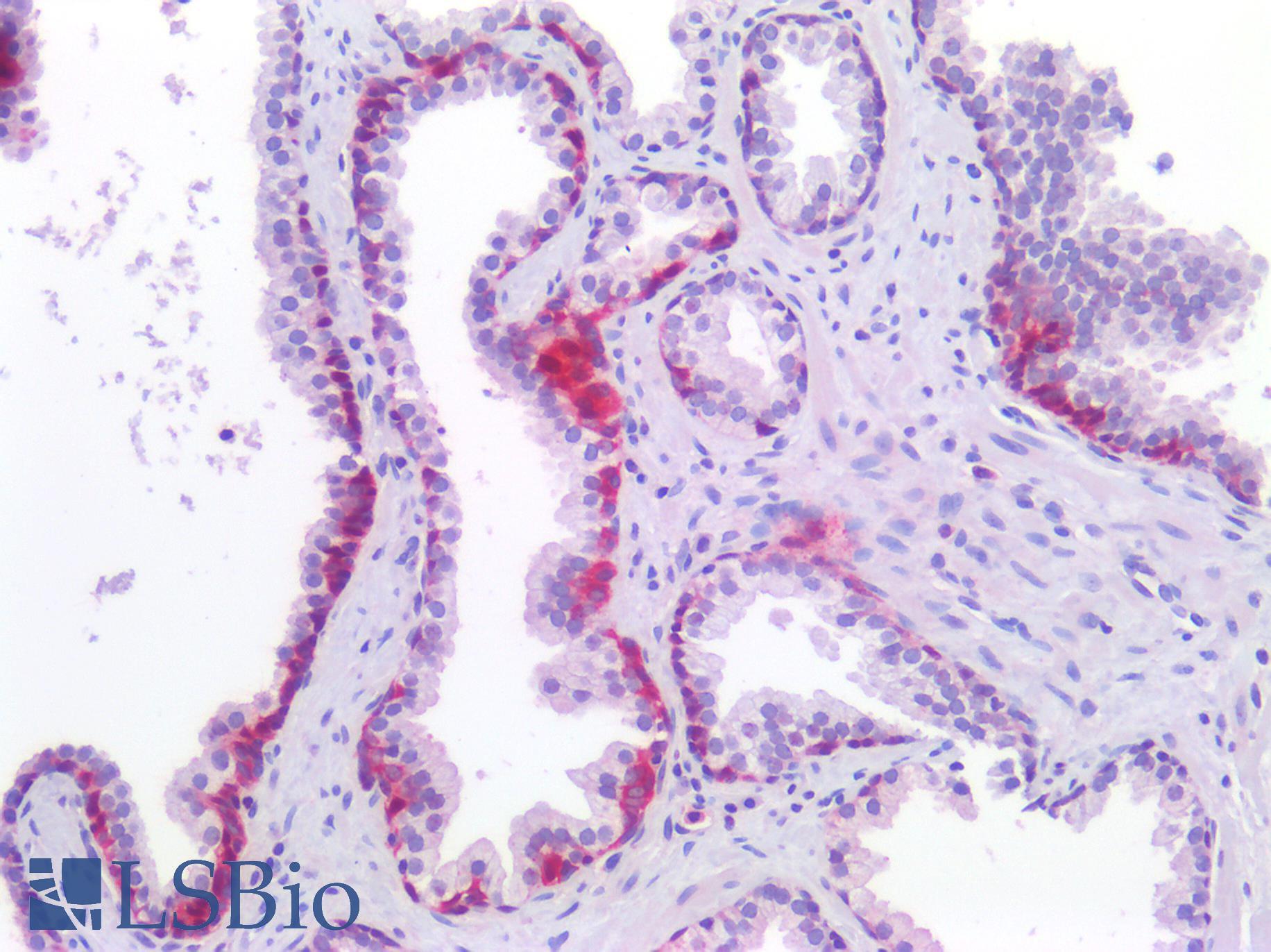 SMN1 Antibody - Human Prostate: Formalin-Fixed, Paraffin-Embedded (FFPE)