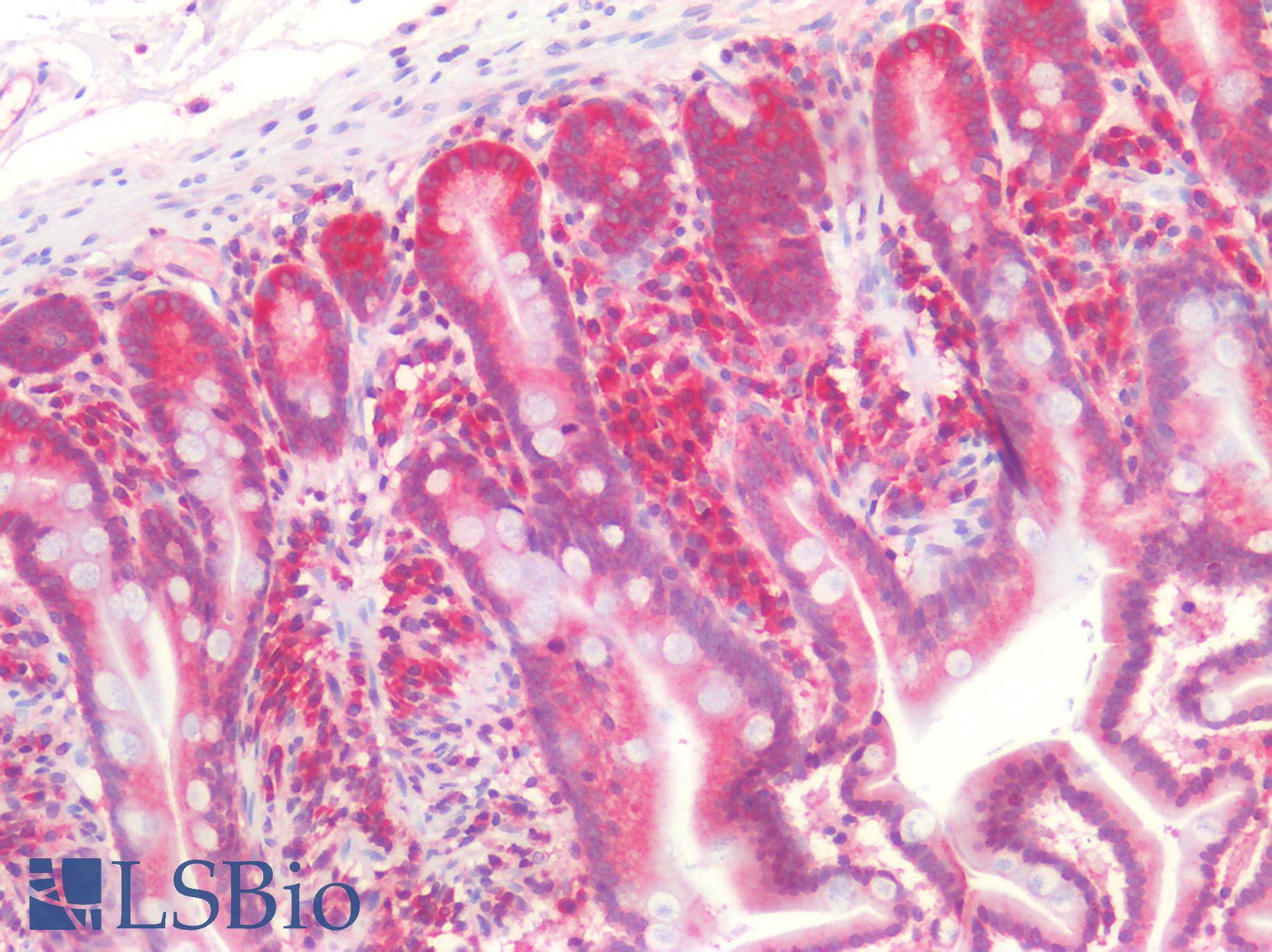 SMN1 Antibody - Human Small Intestine: Formalin-Fixed, Paraffin-Embedded (FFPE)