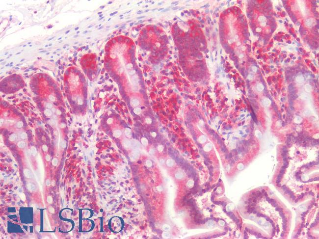 SMN1 Antibody - Human Small Intestine: Formalin-Fixed, Paraffin-Embedded (FFPE)