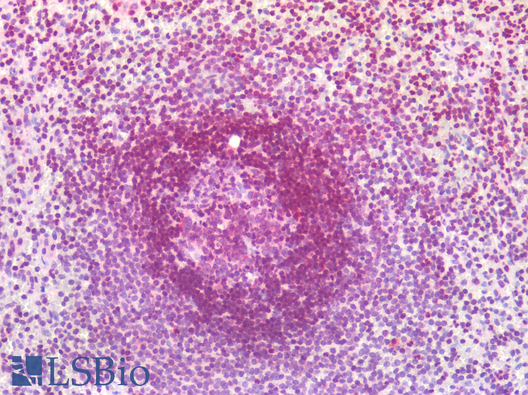 SMN1 Antibody - Human Spleen: Formalin-Fixed, Paraffin-Embedded (FFPE)