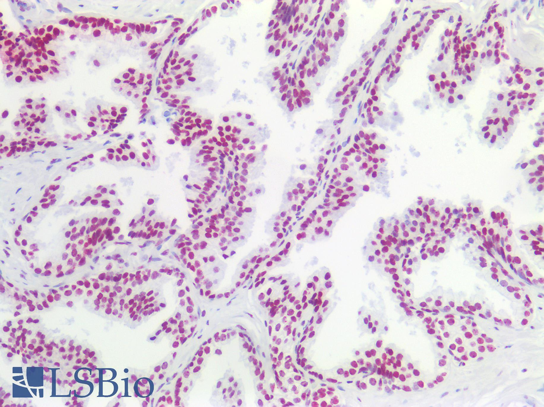 SMN1 Antibody - Human Prostate: Formalin-Fixed, Paraffin-Embedded (FFPE)