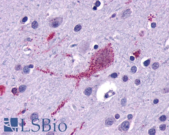 SMO / Smoothened Antibody - Anti-SMO / Smoothened antibody IHC of human brain, cortex. Immunohistochemistry of formalin-fixed, paraffin-embedded tissue after heat-induced antigen retrieval.