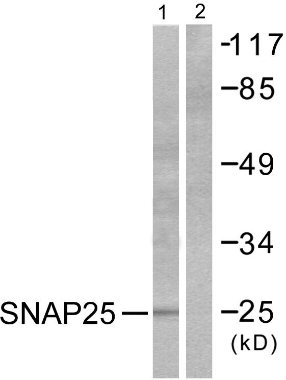 SNAP25 Antibody - Western blot analysis of lysates from Raw264.7 cells, treated with EGF 200ng/ml 30', using SNAP25 Antibody. The lane on the right is blocked with the synthesized peptide.