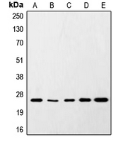 SNAP25 Antibody - Western blot analysis of SNAP25 expression in HeLa (A); SKNSH (B); RAW264.7 (C); PC12 (D); rat brain (E) whole cell lysates.